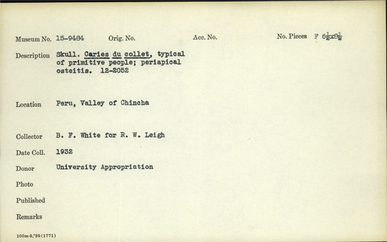 Documentation associated with Hearst Museum object titled Black-and-white negative, accession number 15-9484, described as Skull. Caries du collet, typical of primitive people; pariapical osteitis; 12-2052; Peru, Chincha Valley.