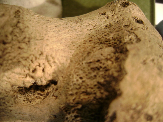 Hearst Museum object 4 of 11 titled Mammal bone, accession number 2-35830, described as Sea lion (?) foot bone. Metapodial.